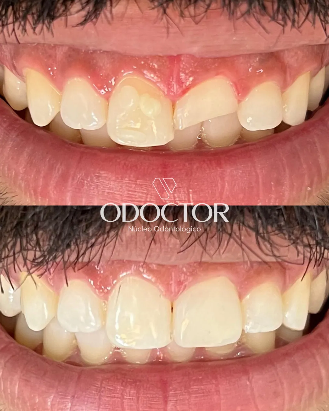 Antes e depois de clínico geral na Odoctor