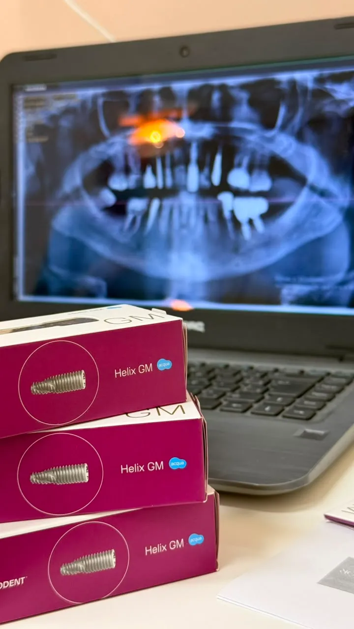 O que é o implante dentário